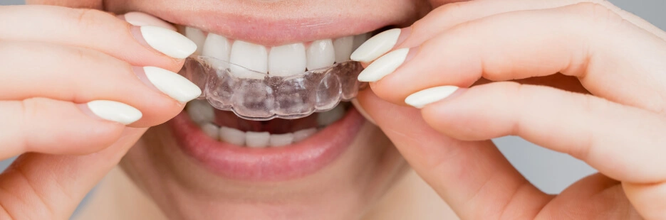 Переваги елайнерів